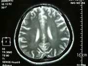 ]MRI